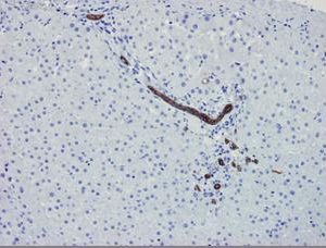 Figure 2. Immunohistochemistry of MUB0316P on paraffin section of human liver. Bile ducts are strongly positive.